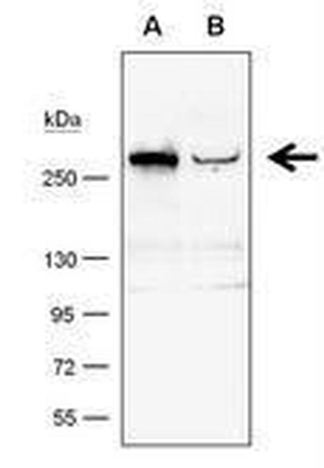 TET1 Antibody in Western Blot (WB)