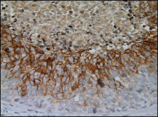 Carbonic Anhydrase IX Antibody in Immunohistochemistry (Paraffin) (IHC (P))