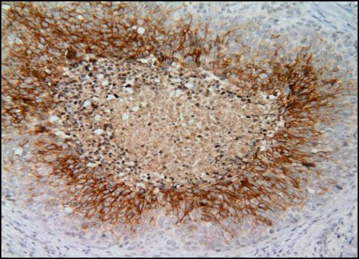 Carbonic Anhydrase IX Antibody in Immunohistochemistry (Paraffin) (IHC (P))