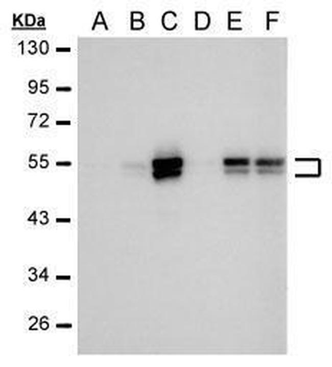 Carbonic Anhydrase IX Antibody in Western Blot (WB)