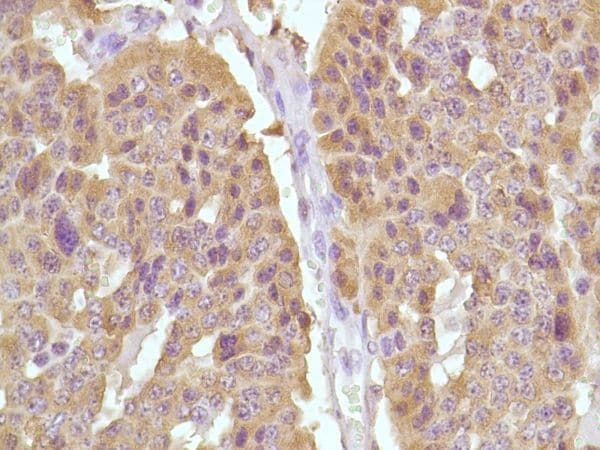 Calcitonin Antibody in Immunohistochemistry (Paraffin) (IHC (P))