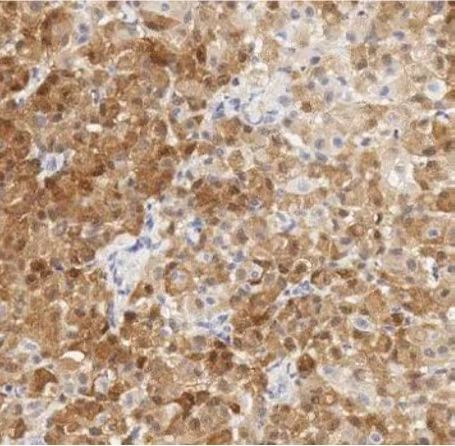 Calpain S1 Antibody in Immunohistochemistry (Paraffin) (IHC (P))