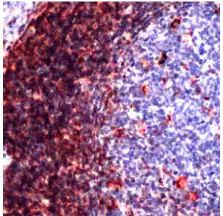 CD43 Antibody in Immunohistochemistry (Paraffin) (IHC (P))