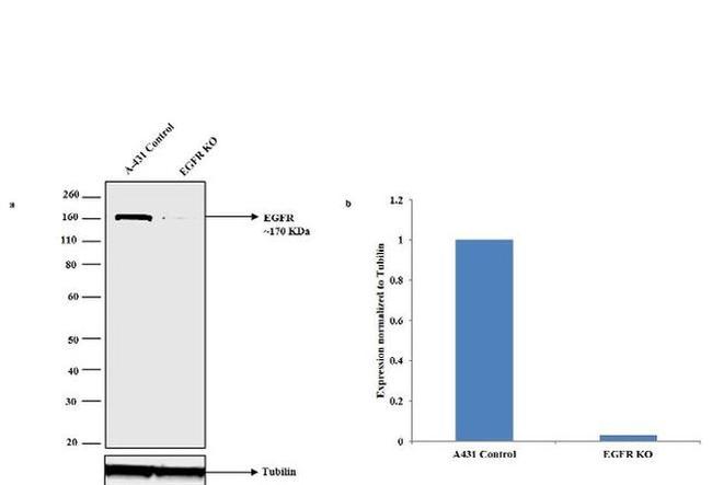 EGFR Antibody in Western Blot (WB)