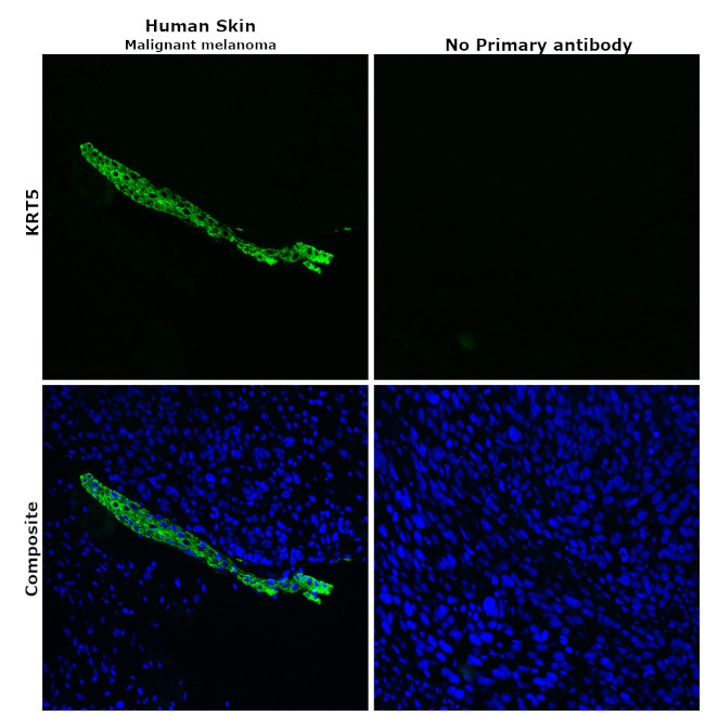 Cytokeratin 5 Antibody in Immunohistochemistry (Paraffin) (IHC (P))