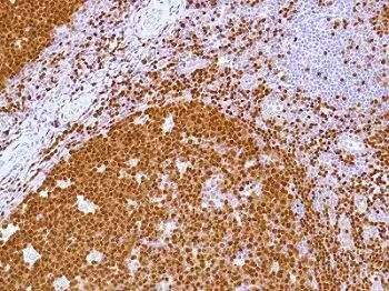 PAX5 Antibody in Immunohistochemistry (Paraffin) (IHC (P))