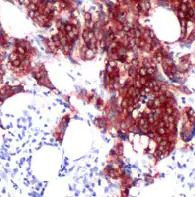 Tau Antibody in Immunohistochemistry (Paraffin) (IHC (P))