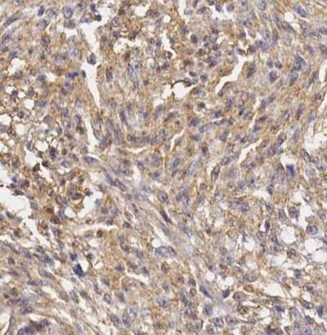 Vimentin Antibody in Immunohistochemistry (Paraffin) (IHC (P))