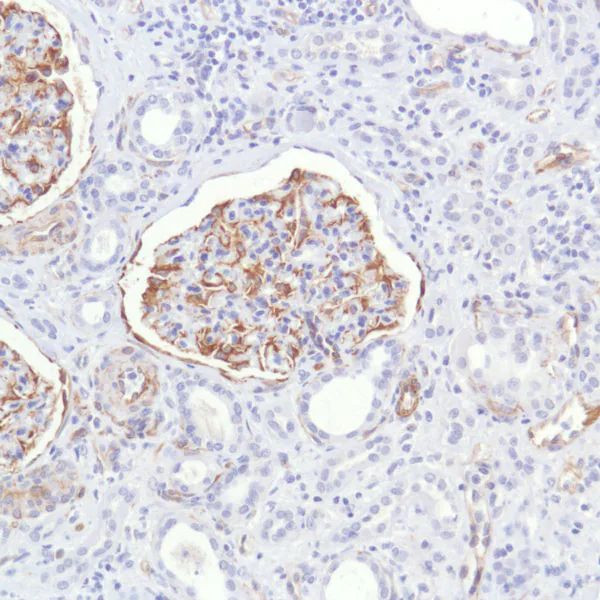 Nestin Antibody in Immunohistochemistry (Paraffin) (IHC (P))