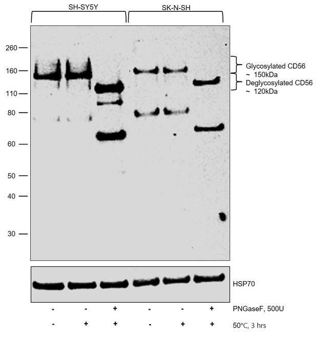 CD56 Antibody in Western Blot (WB)