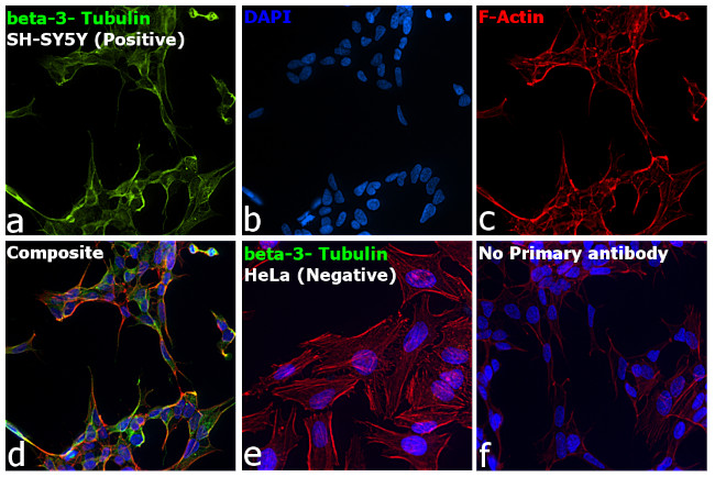 Mouse IgG2a (Heavy chain) Secondary Antibody in Immunocytochemistry (ICC/IF)