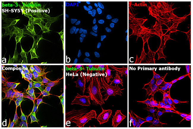 Mouse IgG2a (Heavy chain) Secondary Antibody in Immunocytochemistry (ICC/IF)