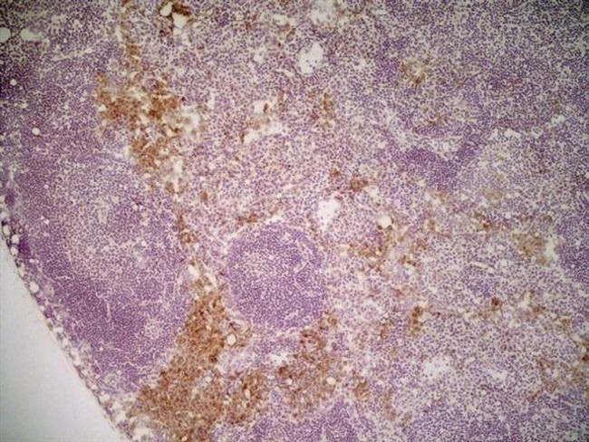 CD206 Antibody in Immunohistochemistry (Frozen) (IHC (F))