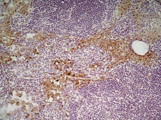 CD206 Antibody in Immunohistochemistry (Frozen) (IHC (F))