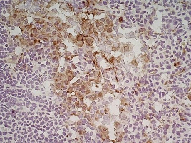 CD206 Antibody in Immunohistochemistry (Frozen) (IHC (F))