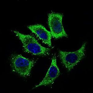 ALDH2 Antibody in Immunocytochemistry (ICC/IF)