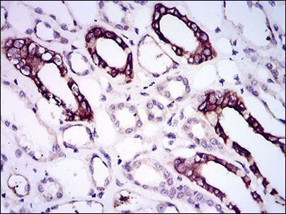 BMPR1A Antibody in Immunohistochemistry (Paraffin) (IHC (P))