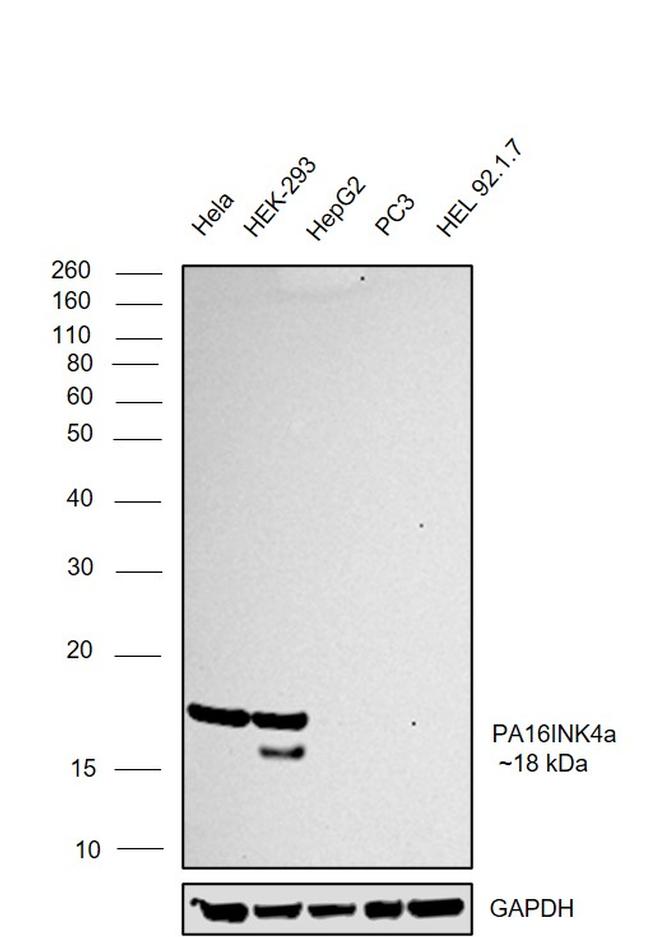 p16INK4a Antibody in Western Blot (WB)