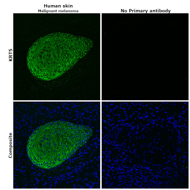 Cytokeratin 5 Antibody in Immunohistochemistry (Paraffin) (IHC (P))