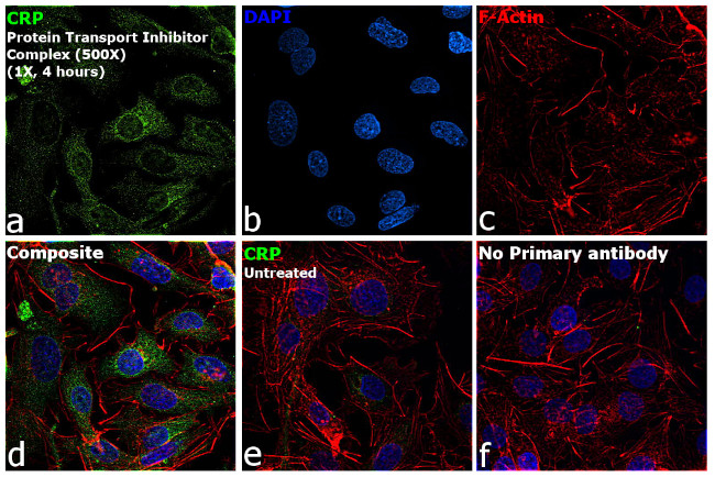 CRP Antibody in Immunocytochemistry (ICC/IF)