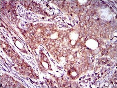 Dynactin 4 Antibody in Immunohistochemistry (Paraffin) (IHC (P))