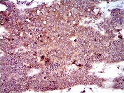 Dynactin 4 Antibody in Immunohistochemistry (Paraffin) (IHC (P))