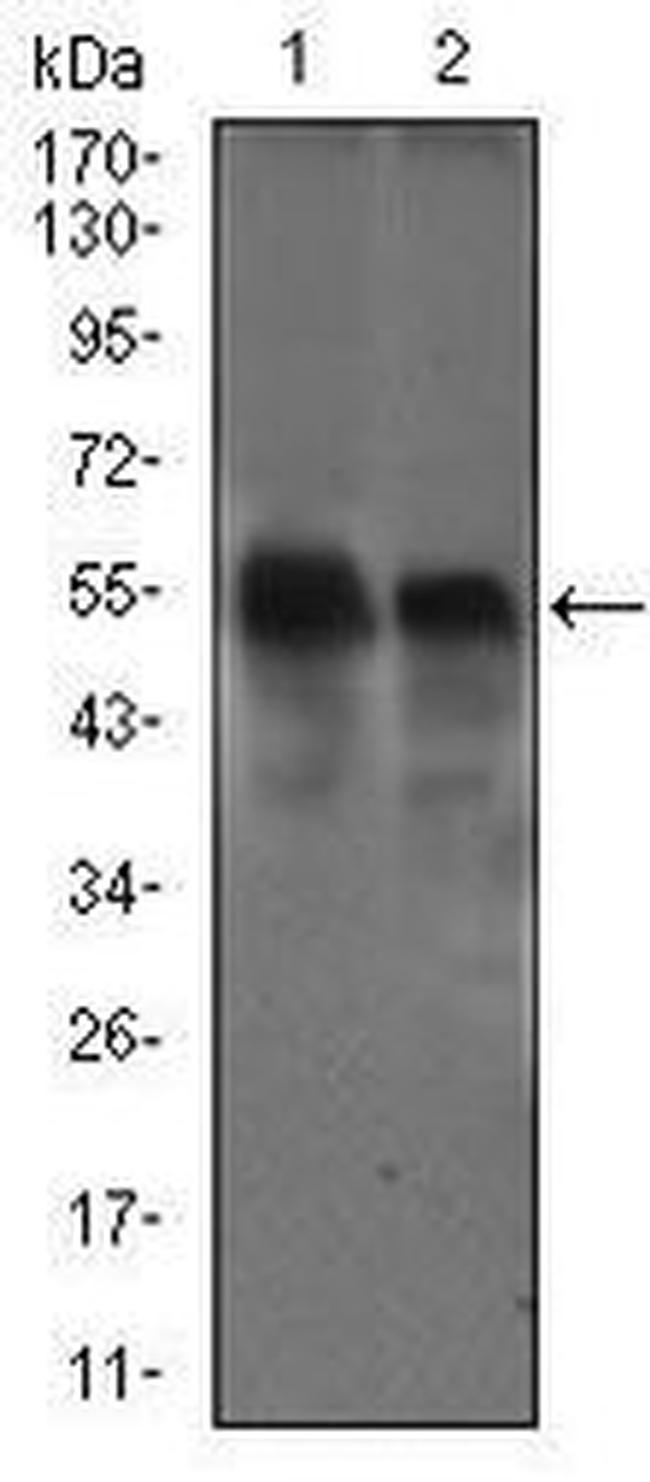 Dynactin 4 Antibody in Western Blot (WB)