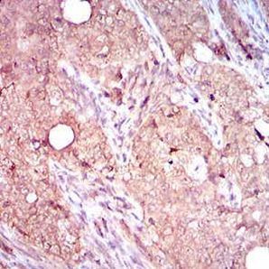 CD104 Antibody in Immunohistochemistry (Paraffin) (IHC (P))