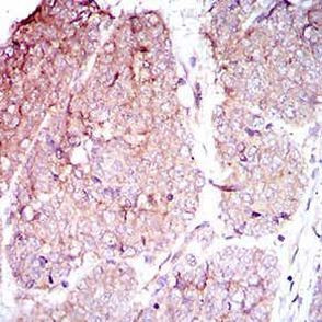 CD104 Antibody in Immunohistochemistry (Paraffin) (IHC (P))