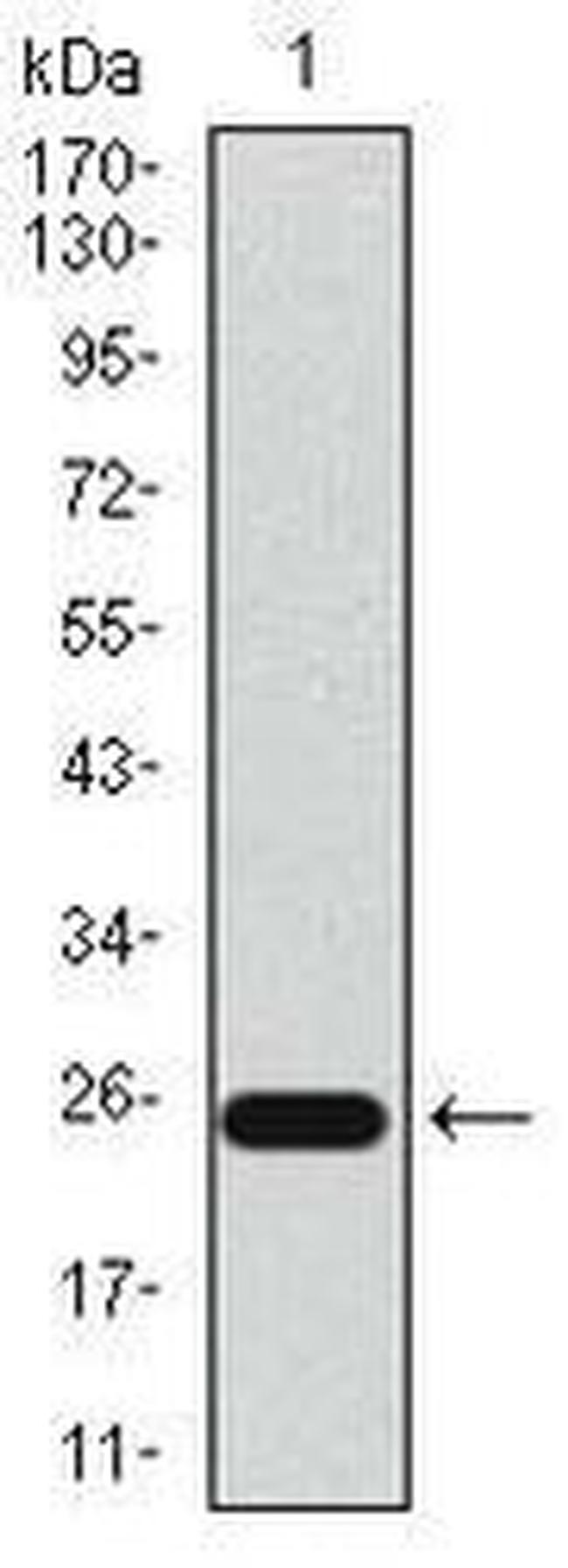 CD104 Antibody in Western Blot (WB)