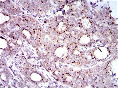 MRPL42 Antibody in Immunohistochemistry (Paraffin) (IHC (P))