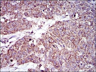 MRPL42 Antibody in Immunohistochemistry (Paraffin) (IHC (P))