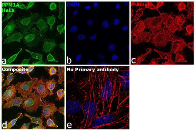 PPM1A Antibody in Immunocytochemistry (ICC/IF)