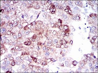 SLC27A5 Antibody in Immunohistochemistry (Paraffin) (IHC (P))