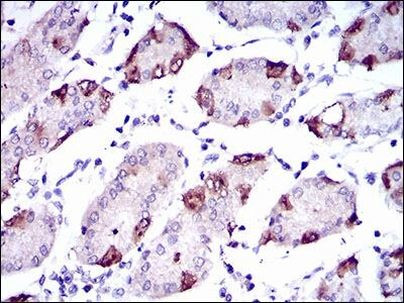 SLC27A5 Antibody in Immunohistochemistry (Paraffin) (IHC (P))