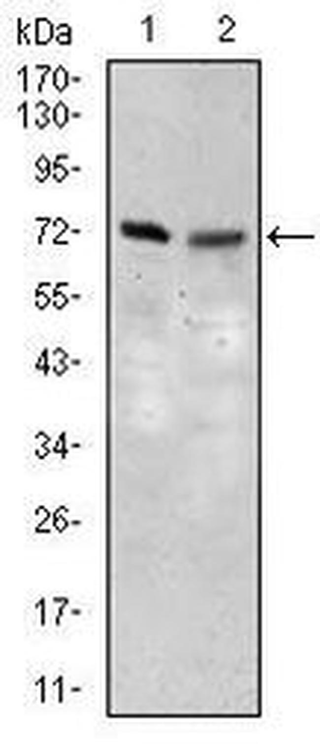 SLC27A5 Antibody in Western Blot (WB)