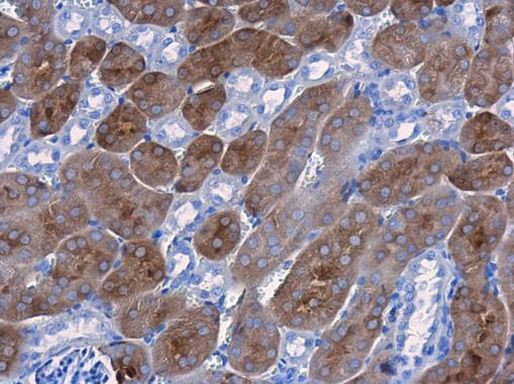 CBS Antibody in Immunohistochemistry (Paraffin) (IHC (P))