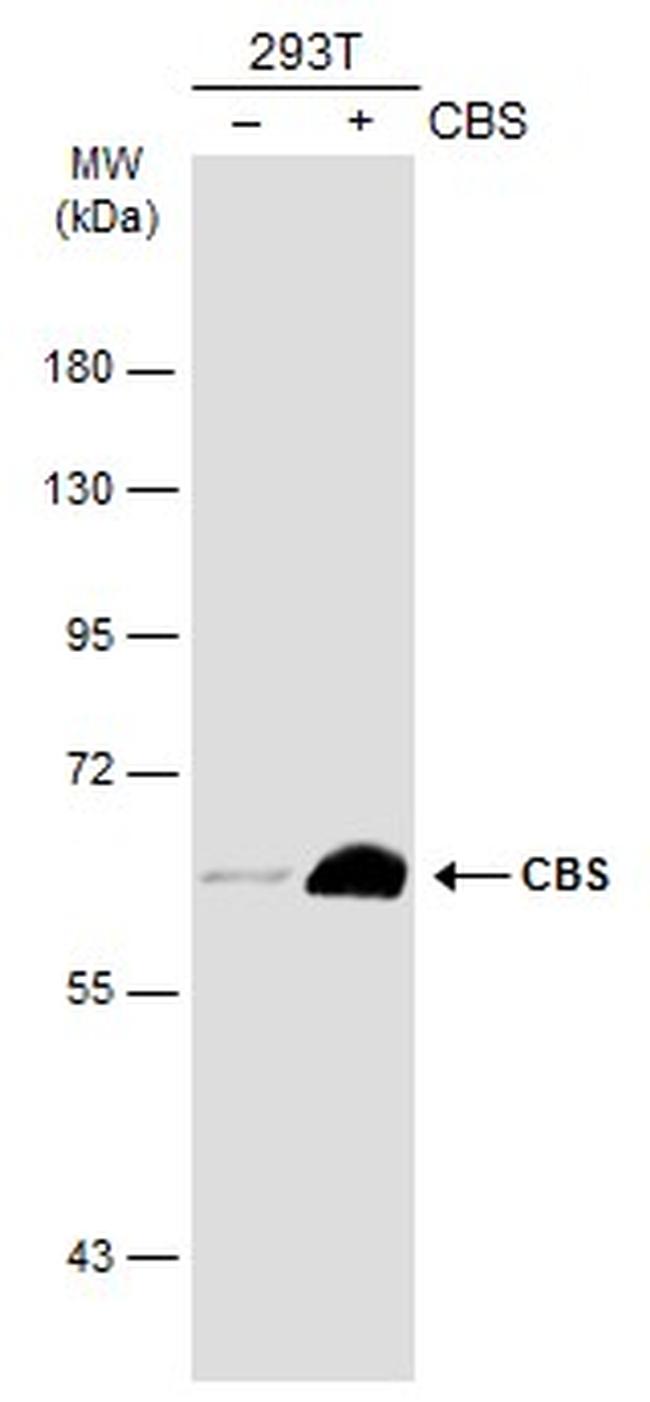 CBS Antibody in Western Blot (WB)