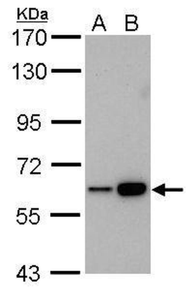 CBS Antibody in Western Blot (WB)