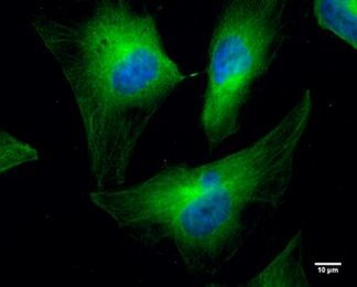 Cofilin Antibody in Immunocytochemistry (ICC/IF)