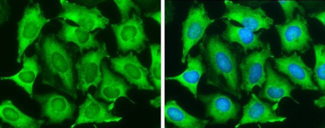 TAGLN Antibody in Immunocytochemistry (ICC/IF)