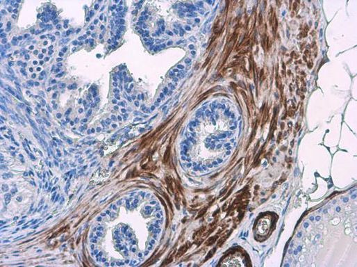 TAGLN Antibody in Immunohistochemistry (Paraffin) (IHC (P))