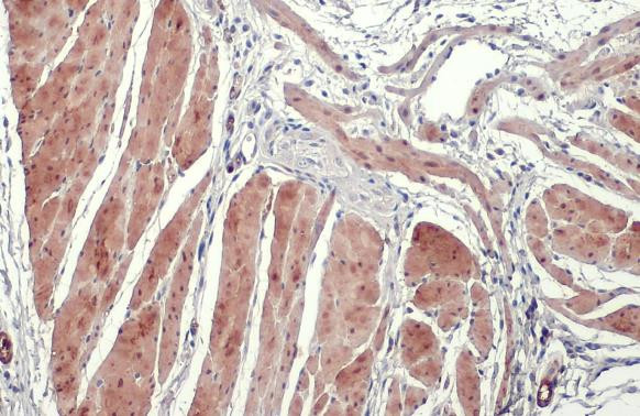 TAGLN Antibody in Immunohistochemistry (Paraffin) (IHC (P))