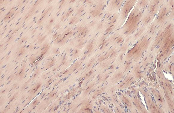 TAGLN Antibody in Immunohistochemistry (Paraffin) (IHC (P))