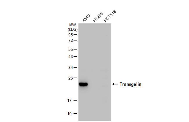 TAGLN Antibody in Western Blot (WB)