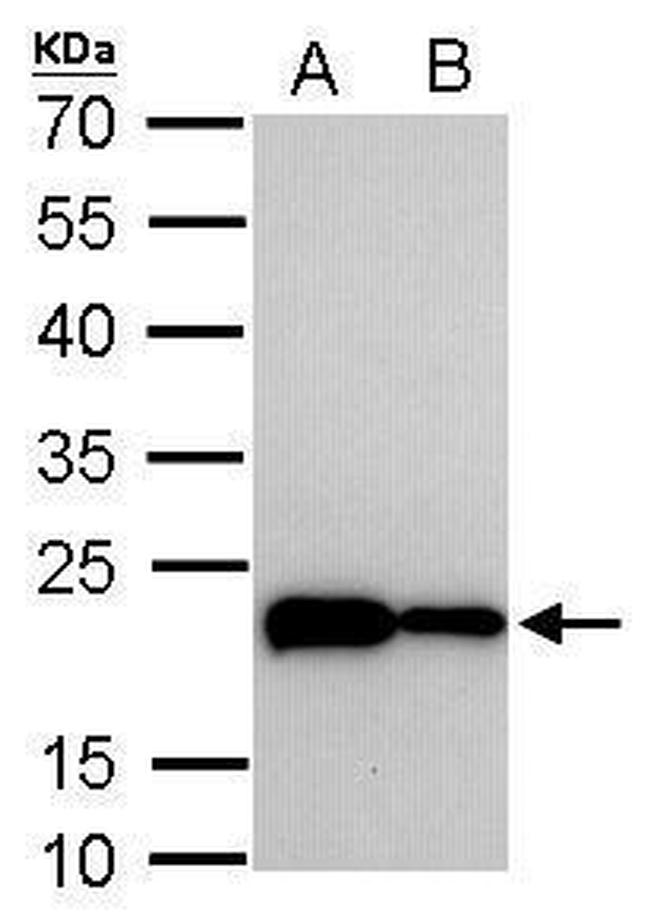 TAGLN Antibody in Western Blot (WB)