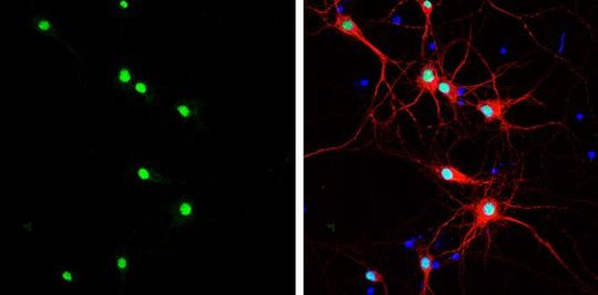 HMGB1 Antibody in Immunocytochemistry (ICC/IF)