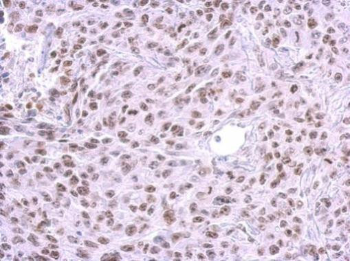 HMGB1 Antibody in Immunohistochemistry (Paraffin) (IHC (P))