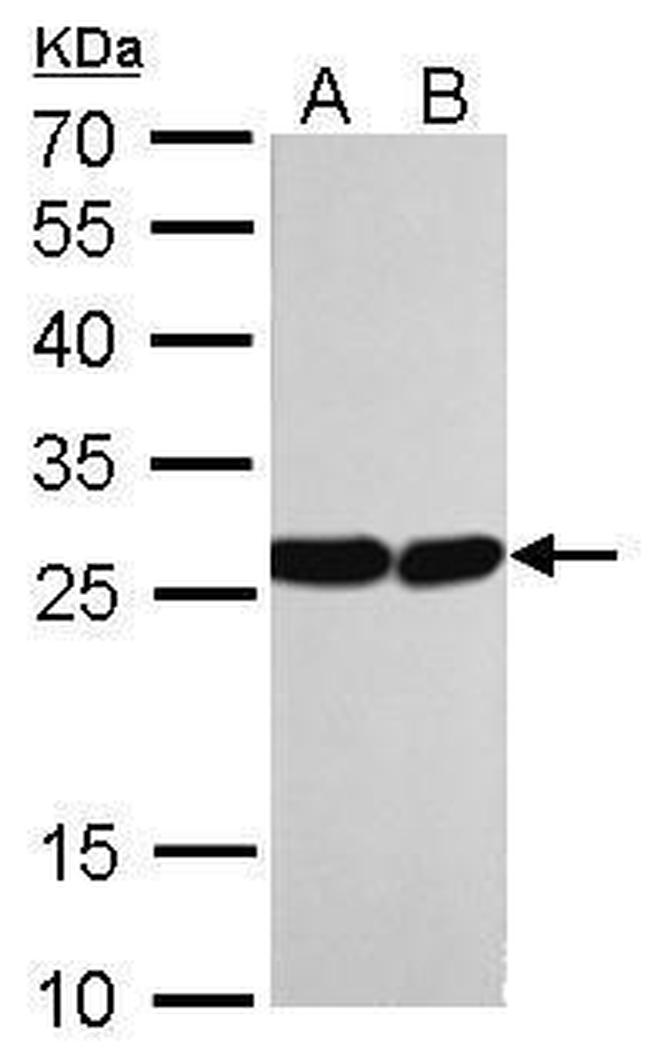 HMGB1 Antibody in Western Blot (WB)