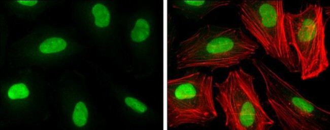 HMGB1 Antibody in Immunocytochemistry (ICC/IF)